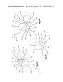 INTERVERTEBRAL IMPLANT diagram and image