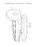 INTERVERTEBRAL DISC diagram and image