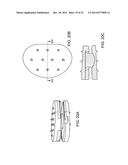 INTERVERTEBRAL DISC diagram and image