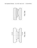 INTERVERTEBRAL DISC diagram and image