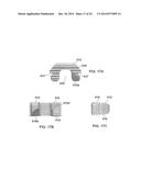 Low Profile Plate diagram and image