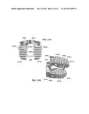 Low Profile Plate diagram and image