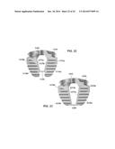 Low Profile Plate diagram and image