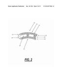 INTERVERTEBRAL IMPLANT DEVICES diagram and image