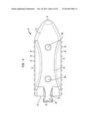 SURGICAL IMPLANT WITH GUIDING RAIL diagram and image