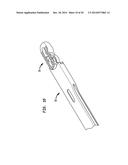 SURGICAL IMPLANT WITH GUIDING RAIL diagram and image