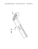 SURGICAL IMPLANT WITH GUIDING RAIL diagram and image