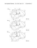 POSTERIOR STABILIZED INSERT TRIAL WITH ADJUSTABLE POST diagram and image