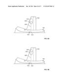 POSTERIOR STABILIZED INSERT TRIAL WITH ADJUSTABLE POST diagram and image