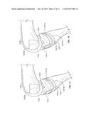 POSTERIOR STABILIZED INSERT TRIAL WITH ADJUSTABLE POST diagram and image