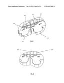 TIBIAL IMPLANT DEVICES, SYSTEMS, AND METHODS diagram and image