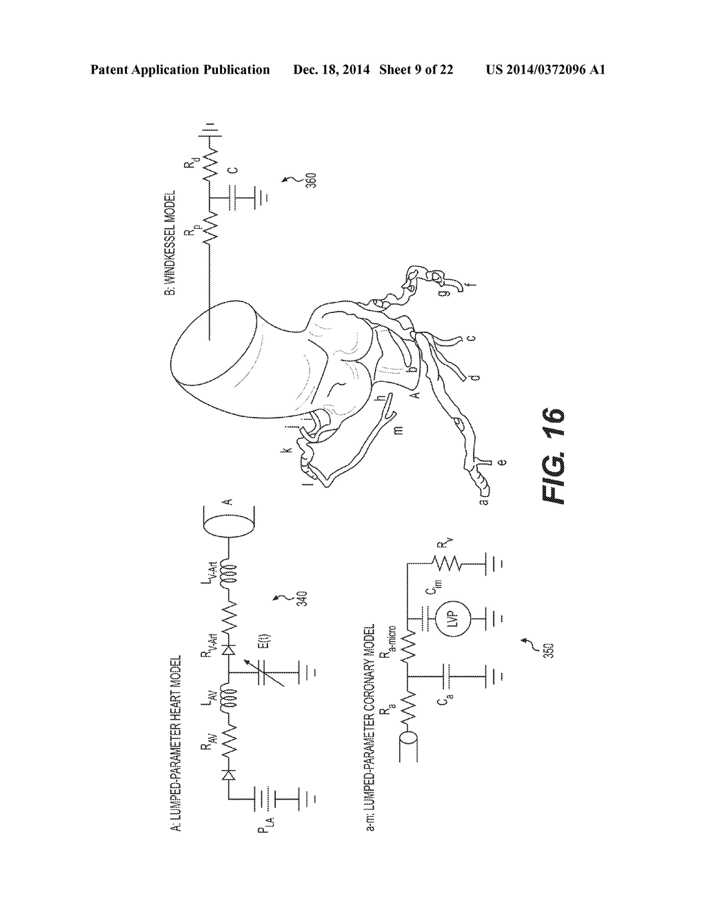 METHOD AND SYSTEM FOR DETERMINING TREATMENTS BY MODIFYING PATIENT-SPECIFIC     GEOMETRICAL MODELS - diagram, schematic, and image 10