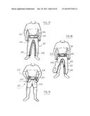 ARTICLE OF CLOTHING FACILITATING ITS OWN STORAGE DURING USE diagram and image