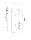 BOND BETWEEN COMPONENTS OF A MEDICAL DEVICE diagram and image