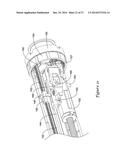 BOND BETWEEN COMPONENTS OF A MEDICAL DEVICE diagram and image