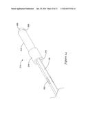 BOND BETWEEN COMPONENTS OF A MEDICAL DEVICE diagram and image