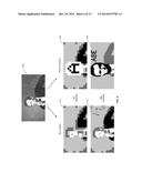 SMART PROSTHESIS FOR FACILITATING ARTIFICIAL VISION USING SCENE     ABSTRACTION diagram and image