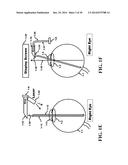 Method and Apparatus for a Self-Focusing Camera and Eyeglass System diagram and image