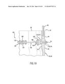 ROOT STIFFENER FOR A WIND TURBINE ROTOR BLADE diagram and image