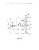 ROOT STIFFENER FOR A WIND TURBINE ROTOR BLADE diagram and image