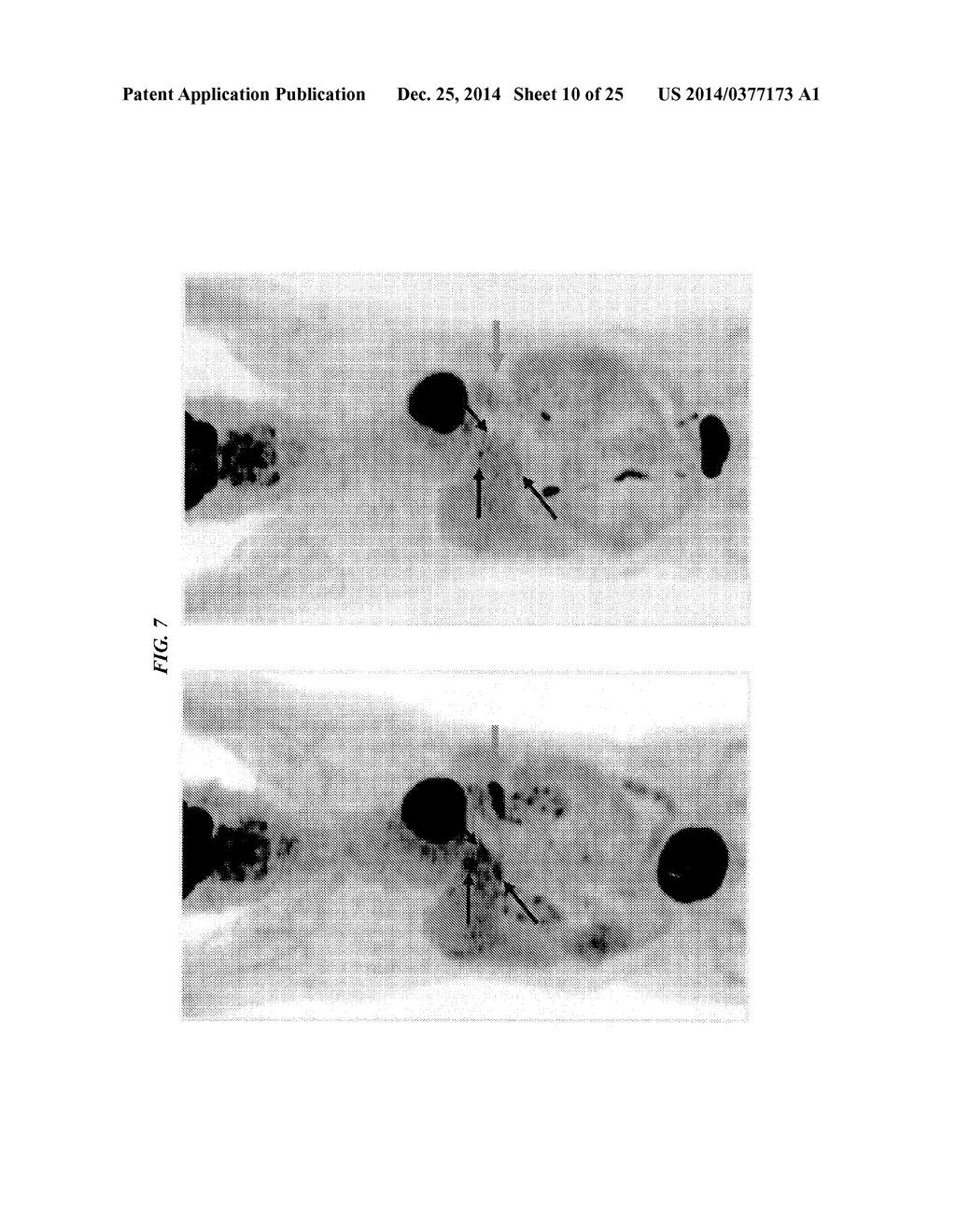 Anti-Mucin Antibodies for Early Detection and Treatment of Pancreatic     Cancer - diagram, schematic, and image 11