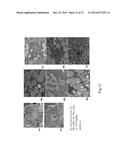 USE OF INTERLEUKIN-22 IN THE TREATMENT OF FATTY LIVER DISEASE diagram and image