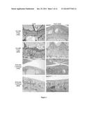 ENZYME REPLACEMENT THERAPY FOR TREATING MPS VII RELATED BONE LESIONS USING     A CHEMICALLY MODIFIED ENZYME diagram and image