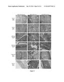 ENZYME REPLACEMENT THERAPY FOR TREATING MPS VII RELATED BONE LESIONS USING     A CHEMICALLY MODIFIED ENZYME diagram and image