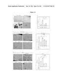 CLEAVAGE INHIBITORS OF TRANSFORMING GROWTH FACTOR BETA TYPE I RECEPTOR AND     USES THEREOF IN CANCER THERAPY diagram and image
