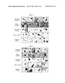 METHOD FOR CULTURING ISLET CELLS AND METHOD FOR PREPARING CARRIER FOR     ISLET CELL TRANSPLANTATION USING ATELOCOLLAGEN, AND ARTIFICIAL PANCREAS     PREPARED USING SAME diagram and image