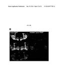 TRANSPOSON ACTIVATION DURING AGING AND NEURONAL DECLINE diagram and image