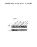 TRANSPOSON ACTIVATION DURING AGING AND NEURONAL DECLINE diagram and image