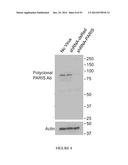 TRANSCRIPTIONAL REPRESSION LEADING TO PARKINSON S DISEASE diagram and image