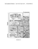 TRANSCRIPTIONAL REPRESSION LEADING TO PARKINSON S DISEASE diagram and image