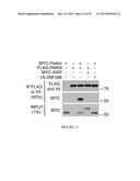 TRANSCRIPTIONAL REPRESSION LEADING TO PARKINSON S DISEASE diagram and image