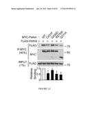 TRANSCRIPTIONAL REPRESSION LEADING TO PARKINSON S DISEASE diagram and image