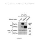 TRANSCRIPTIONAL REPRESSION LEADING TO PARKINSON S DISEASE diagram and image