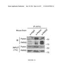 TRANSCRIPTIONAL REPRESSION LEADING TO PARKINSON S DISEASE diagram and image