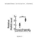 TRANSCRIPTIONAL REPRESSION LEADING TO PARKINSON S DISEASE diagram and image