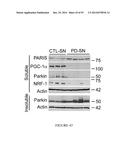 TRANSCRIPTIONAL REPRESSION LEADING TO PARKINSON S DISEASE diagram and image