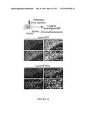 TRANSCRIPTIONAL REPRESSION LEADING TO PARKINSON S DISEASE diagram and image