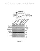 TRANSCRIPTIONAL REPRESSION LEADING TO PARKINSON S DISEASE diagram and image