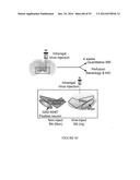 TRANSCRIPTIONAL REPRESSION LEADING TO PARKINSON S DISEASE diagram and image