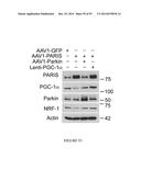 TRANSCRIPTIONAL REPRESSION LEADING TO PARKINSON S DISEASE diagram and image