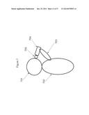 FACIAL TREATMENT DEVICE diagram and image