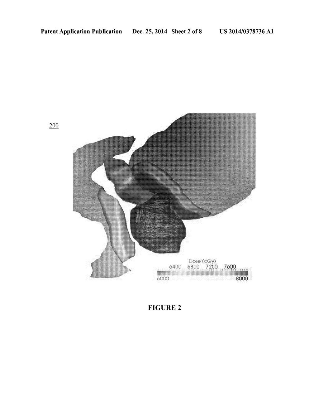 METHODS, SYSTEMS AND COMPUTER READABLE STORAGE MEDIA STORING INSTRUCTIONS     FOR GENERATING A RADIATION THERAPY TREATMENT PLAN - diagram, schematic, and image 03