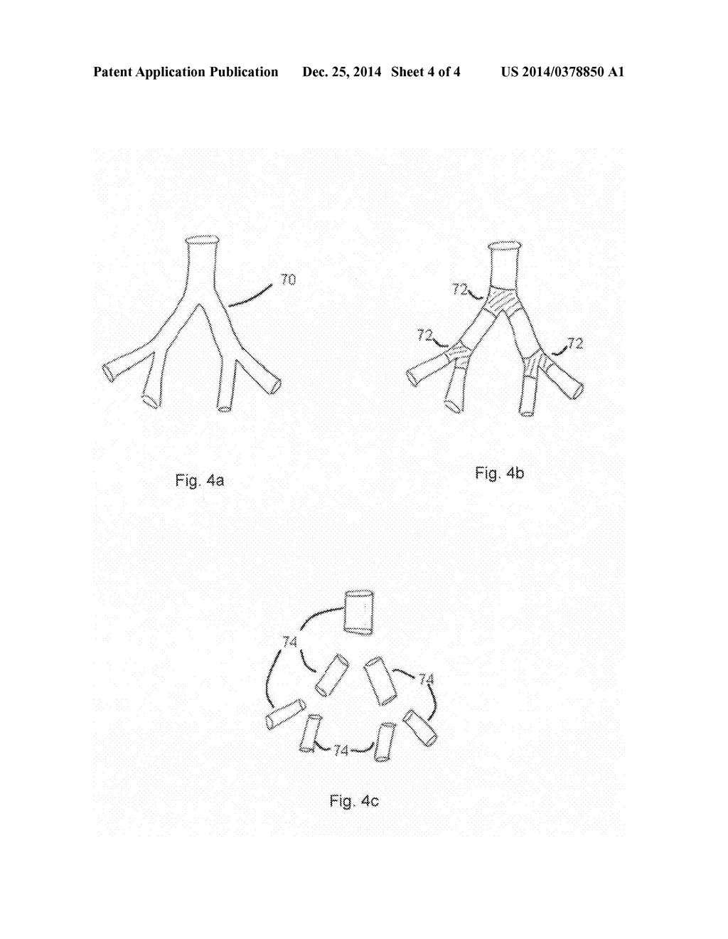 METHOD OF, AND APPARATUS FOR, PROCESSING VOLUMETRIC IMAGE DATA - diagram, schematic, and image 05