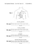 ATRIAL ACTIVITY SIGNAL ESTIMATION USING INDEPENDENT COMPONENT ANALYSIS diagram and image