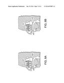 METHODS, DEVICES AND SYSTEMS FOR INCREASING THE EFFECTIVENESS OF     ULTRASOUND AND OTHER TISSUE TREATMENT MODALITIES diagram and image