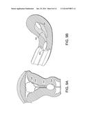 METHODS, DEVICES AND SYSTEMS FOR INCREASING THE EFFECTIVENESS OF     ULTRASOUND AND OTHER TISSUE TREATMENT MODALITIES diagram and image